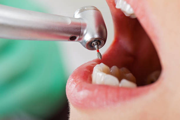 Best Emergency Treatment for Toothache in Helmetta, NJ